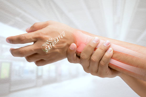 Working with a broken wrist Working with a broken wrist